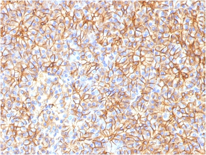 IHC-P analysis of human pancreas tissue using GTX35091 SPTBN2 antibody [SPTBN2/1584].
