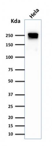 WB analysis of HeLa cell lysate using GTX35091 SPTBN2 antibody [SPTBN2/1584].
