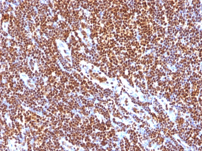 IHC-P analysis of human tonsil tissue using GTX35094 SUMO1 antibody [SUMO1/1188].