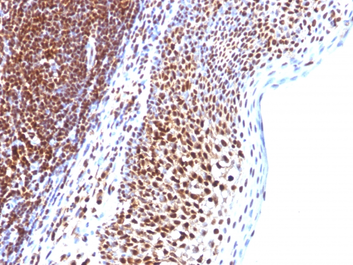 IHC-P analysis of human tonsil tissue using GTX35094 SUMO1 antibody [SUMO1/1188].