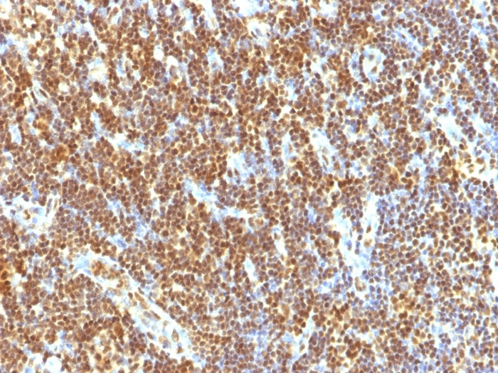 IHC-P analysis of human tonsil tissue using GTX35095 SUMO2 antibody [SUMO2/1199].