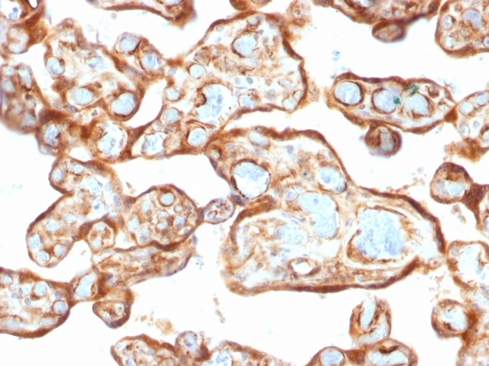 Formalin-fixed,paraffin-embedded human Placenta stained with Thymidine Phosphorylase / PD-ECGF Monoclonal Antibody (P-GF.44C).