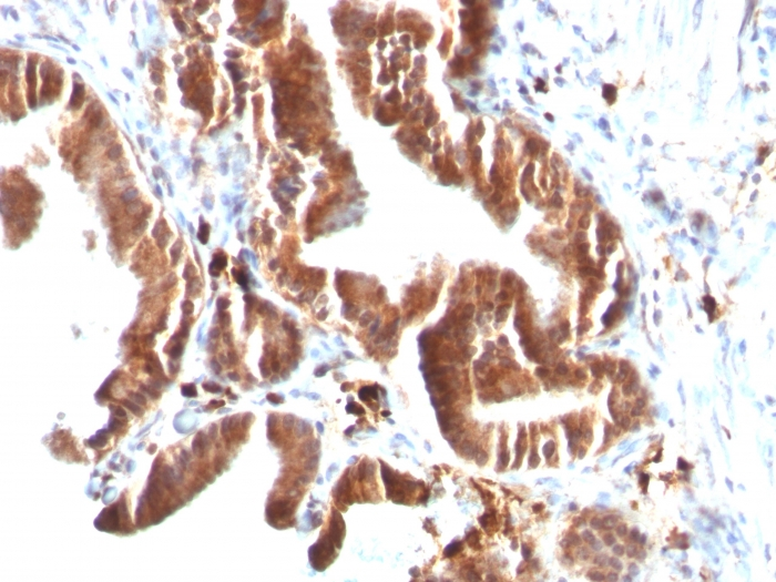 Formalin-fixed,paraffin-embedded human Gallbladder stained with Topo I,MT Monoclonal Antibody (TOP1MT/488).