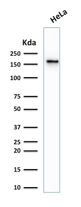 Western Blot of HepG2,HeLa and 3T3 Cell Lysate using Topo II alpha,Monoclonal Antibody (TOP2A/1361).