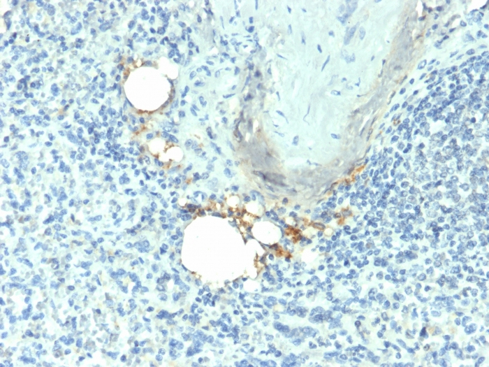 Formalin-fixed,paraffin-embedded human Spleen stained with TRAcP Monoclonal Antibody (ACP5/1070)