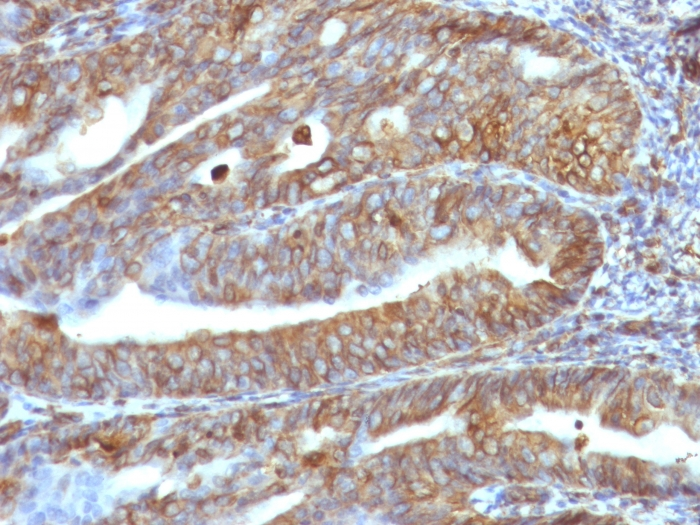 IHC-P analysis of human uterus tissue using GTX35163 Vimentin antibody [VM1170].