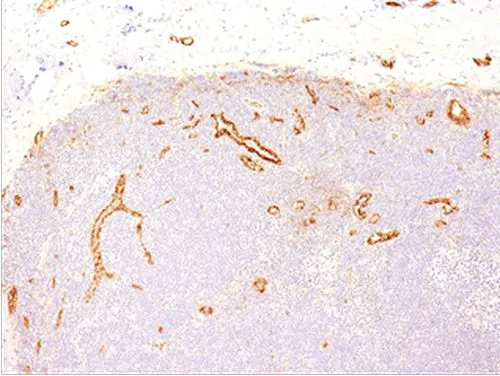 IHC-P analysis of human tonsil tissue using GTX35166 VWF antibody [VWF635].