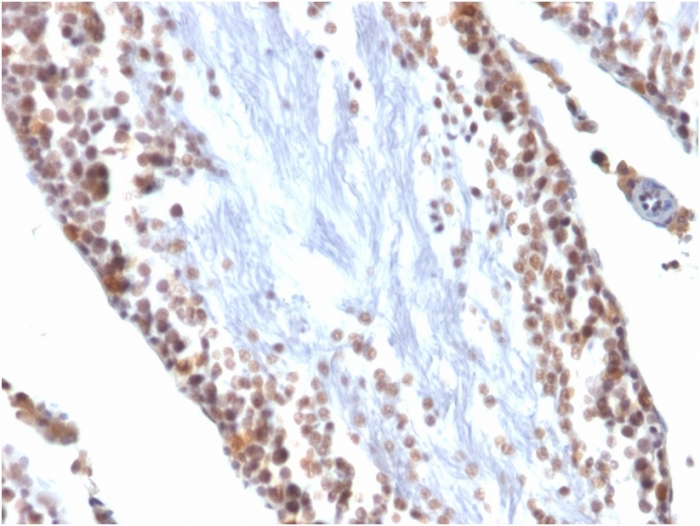 IHC-P analysis of rat testis tissue using GTX35174 Wilms Tumor 1 antibody [WT1/857].