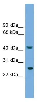 WB Suggested Anti-RAB35 Antibody Titration: 0.2-1 ug/ml Positive Control: Human Liver WB Suggested Anti-RAB35 Antibody Titration: 0.2-1 ug/ml Positive Control: Human Liver