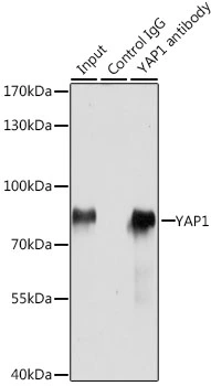 IP analysis of HeLa cell lysate using GTX35195 YAP1 antibody. Antibody amount : 3microg / 200microg lysate Dilution : 1:1000 IP analysis of HeLa cell lysate using GTX35195 YAP1 antibody. Antibody amount : 3microg / 200microg lysate Dilution : 1:1000