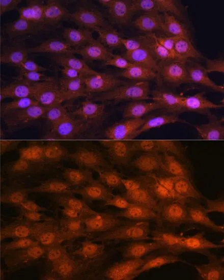 ICC/IF analysis of C6 cells using GTX35195 YAP1 antibody. Blue : DAPI Dilution : 1:100
