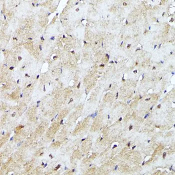 IHC-P analysis of mouse heart tissue using GTX35195 YAP1 antibody. Dilution : 1:100