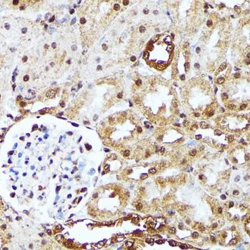 IHC-P analysis of rat kidney tissue using GTX35195 YAP1 antibody. Dilution : 1:100