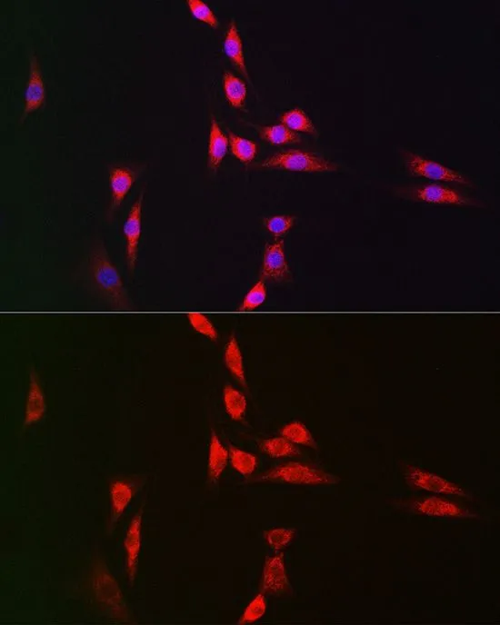 ICC/IF analysis of A549 cells using GTX35196 NFkB p105 antibody.