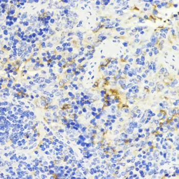 IHC-P analysis of mouse spleen tissue using GTX35196 NFkB p105 antibody. Dilution : 1:200