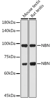 WB analysis of various sample lysates using GTX35197 NBS1 antibody. Dilution : 1:1000 Loading : 25microg per lane