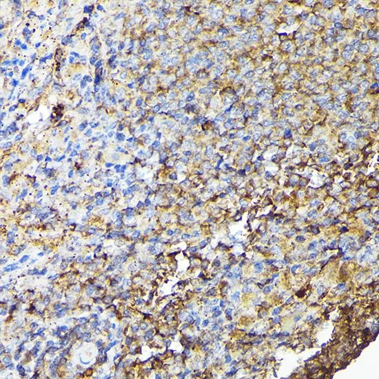 IHC-P analysis of mouse spleen tissue using GTX35201 CSK antibody. Dilution : 1:100