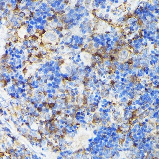 IHC-P analysis of rat spleen tissue using GTX35201 CSK antibody. Dilution : 1:100