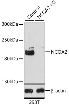 WB analysis of various sample lysates using GTX35206 NCOA2 antibody. Dilution : 1:1000 Loading : 25microg per lane