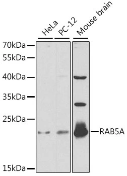 WB analysis of various sample lysates using GTX35207 RAB5A antibody. Dilution : 1:1000 Loading : 25microg per lane