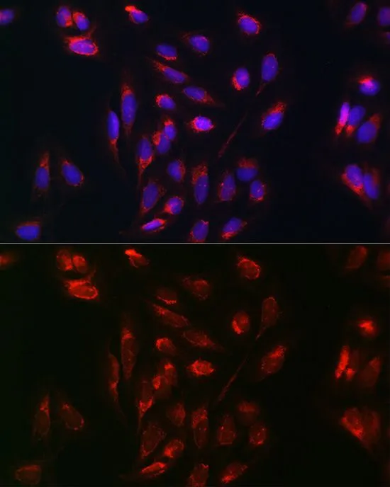 ICC/IF analysis of U2OS cells using GTX35207 RAB5A antibody. Blue : DAPI Dilution : 1:100