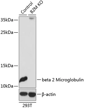 WB analysis of normal (control) and knockout (KO) 293T cell lysate using GTX35209 beta 2 Microglobulin antibody. Dilution : 1:3000 Loading : 25microg per lane WB analysis of normal (control) and knockout (KO) 293T cell lysate using GTX35209 beta 2 Microglobulin antibody. Dilution : 1:3000 Loading : 25microg per lane