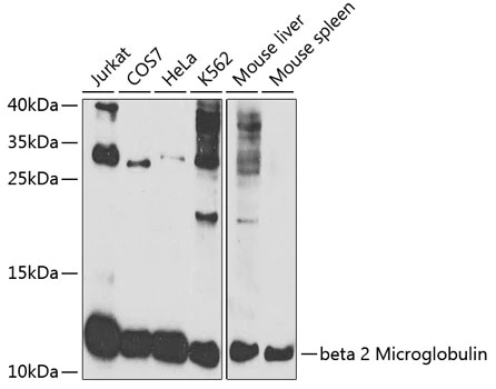 WB analysis of various sample lysates using GTX35209 beta 2 Microglobulin antibody. Dilution : 1:1000 Loading : 25microg per lane