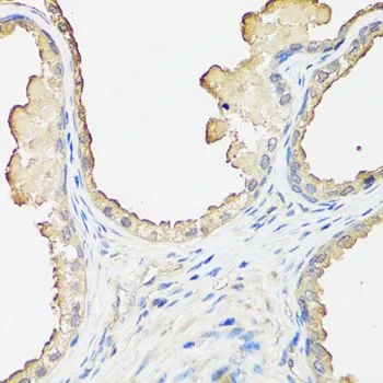 IHC-P analysis of human prostate tissue using GTX35209 beta 2 Microglobulin antibody. Dilution : 1:100
