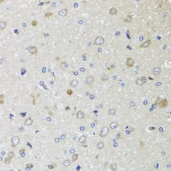 IHC-P analysis of rat brain tissue using GTX35209 beta 2 Microglobulin antibody. Dilution : 1:100