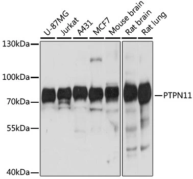 WB analysis of various sample lysates using GTX35210 SHP2 antibody. Dilution : 1:1000 Loading : 25microg per lane