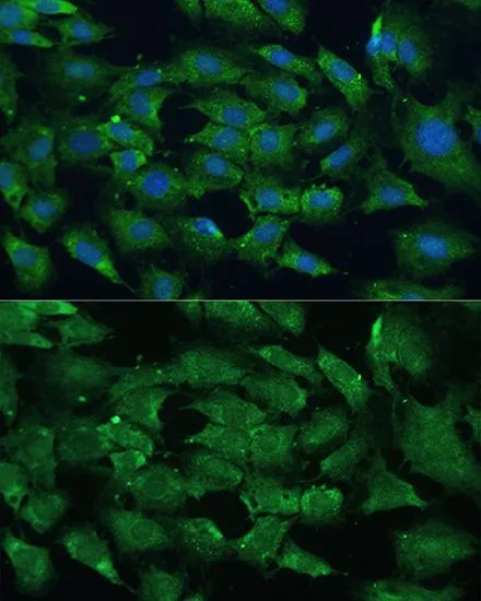ICC/IF analysis of C6 cells using GTX35210 SHP2 antibody. Blue : DAPI Dilution : 1:100
