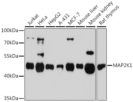 WB analysis of various sample lysates using GTX35212 MEK1 antibody. The signal was developed with ECL plus-Enhanced. Dilution : 1:3000 Loading : 25microg per lane
