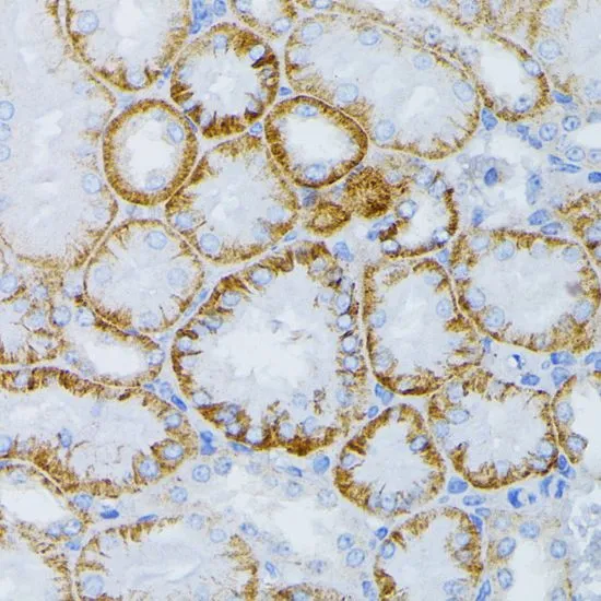IHC-P analysis of mouse kidney tissue using GTX35212 MEK1 antibody. Dilution : 1:100