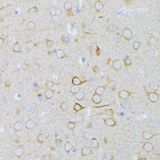 IHC-P analysis of rat brain tissue using GTX35212 MEK1 antibody. Dilution : 1:100