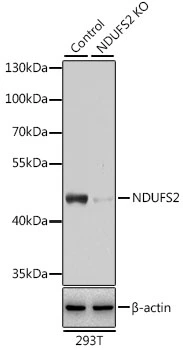 WB analysis of normal (control) and knockout (KO) 293T cell lysate using GTX35213 NDUFS2 antibody. Dilution : 1:3000 Loading : 25microg per lane WB analysis of normal (control) and knockout (KO) 293T cell lysate using GTX35213 NDUFS2 antibody. Dilution : 1:3000 Loading : 25microg per lane