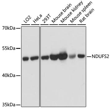 WB analysis of various sample lysates using GTX35213 NDUFS2 antibody. Dilution : 1:3000 Loading : 25microg per lane