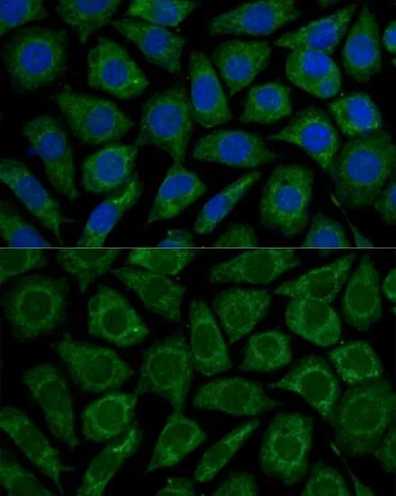 ICC/IF analysis of L929 cells using GTX35213 NDUFS2 antibody. Blue : DAPI Dilution : 1:100