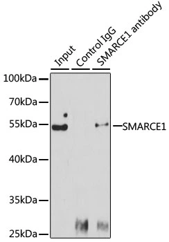 IP analysis of Jurkat cell lysate using GTX35217 BAF57 antibody. Antibody amount : 3microg / 150microg lysate Dilution : 1:1000