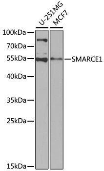 WB analysis of various sample lysates using GTX35217 BAF57 antibody. Dilution : 1:1000 Loading : 25microg per lane