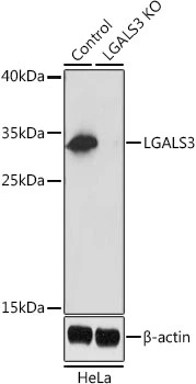 WB analysis of normal (control) and knockout (KO) HeLa cell lysate using GTX35218 Galectin 3 antibody. Dilution : 1:1000 Loading : 25microg per lane WB analysis of normal (control) and knockout (KO) HeLa cell lysate using GTX35218 Galectin 3 antibody. Dilution : 1:1000 Loading : 25microg per lane