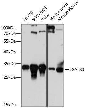 WB analysis of various sample lysates using GTX35218 Galectin 3 antibody. Dilution : 1:1000 Loading : 25microg per lane