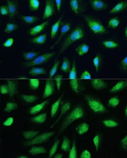 ICC/IF analysis of U2OS cells using GTX35218 Galectin 3 antibody. Blue : DAPI Dilution : 1:100
