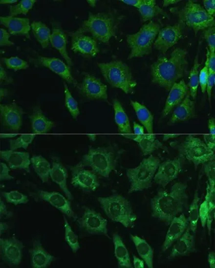 ICC/IF analysis of C6 cells using GTX35218 Galectin 3 antibody. Blue : DAPI Dilution : 1:100