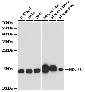 WB analysis of various sample lysates using GTX35219 NDUFB4 antibody. Dilution : 1:3000 Loading : 25microg per lane