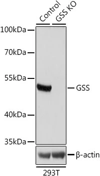 WB analysis of normal (control) and knockout (KO) 293T cell lysate using GTX35220 GSS antibody. Dilution : 1:1000 Loading : 25microg per lane WB analysis of normal (control) and knockout (KO) 293T cell lysate using GTX35220 GSS antibody. Dilution : 1:1000 Loading : 25microg per lane