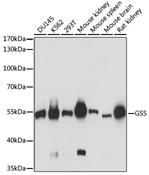 WB analysis of various sample lysates using GTX35220 GSS antibody. Dilution : 1:3000 Loading : 25microg per lane