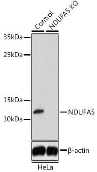 WB analysis of normal (control) and knockout (KO) HeLa cell lysate using GTX35222 NDUFA5 antibody. Dilution : 1:1000 Loading : 25microg per lane WB analysis of normal (control) and knockout (KO) HeLa cell lysate using GTX35222 NDUFA5 antibody. Dilution : 1:1000 Loading : 25microg per lane