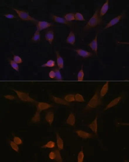 ICC/IF analysis of NIH/3T3 cells using GTX35222 NDUFA5 antibody. Blue : DAPI Dilution : 1:100