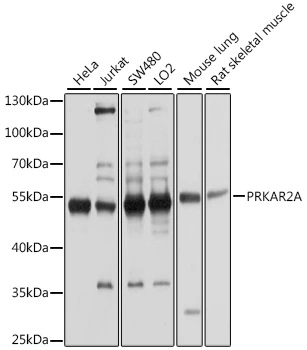 WB analysis of various sample lysates using GTX35228 PKA R2 antibody. Dilution : 1:1000 Loading : 25microg per lane