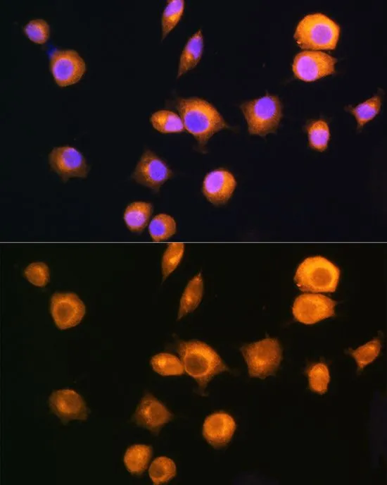 ICC/IF analysis of L929 cells using GTX35228 PKA R2 antibody. Blue : DAPI Dilution : 1:100